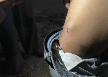 ភ្លៅខាងស្ដាំរបស់លោក ឡុង ប៊ុនណារា រងរបួសដោយសារគ្រាប់កាំភ្លើងខ្យល់ឬកាំភ្លើងកែច្នៃ ក្រុមសន្តិសុខរបស់លោកឧកញ៉ា រតនៈ សម្បត្តិ នៅយប់ថ្ងៃទី១៥ ខែធ្នូ ឆ្នាំ២០២៤។ (រូបភាពផ្ដល់ឱ្យ)